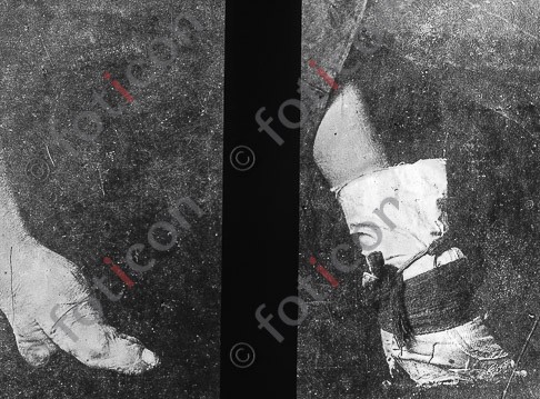 Verkrüppelte Füße ; Crippled foot - Foto simon-173a-038-sw.jpg | foticon.de - Bilddatenbank für Motive aus Geschichte und Kultur